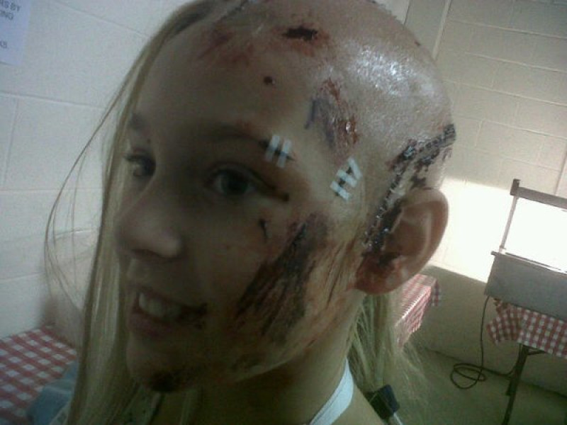 Main image for Shania makes a dramatic recovery from 'gruesome injuries'