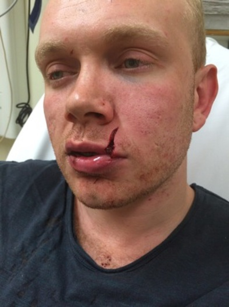 Main image for Attack victim likely to be scarred for life