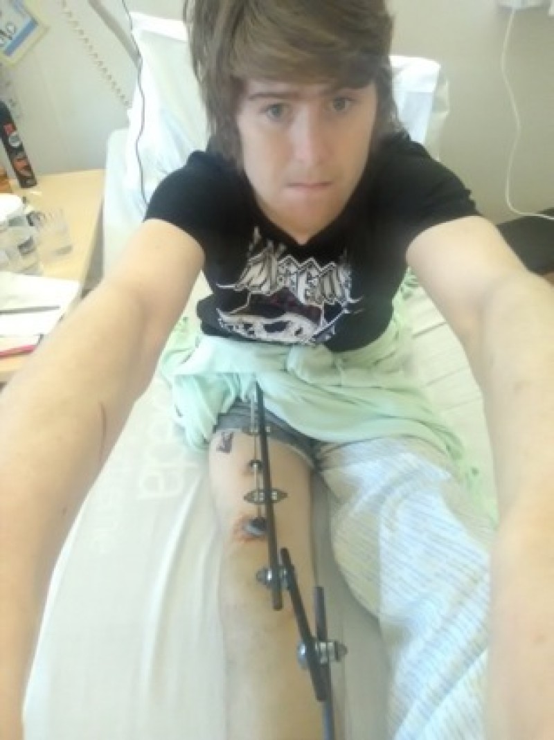 Main image for Lad has surgery after falling down quarry