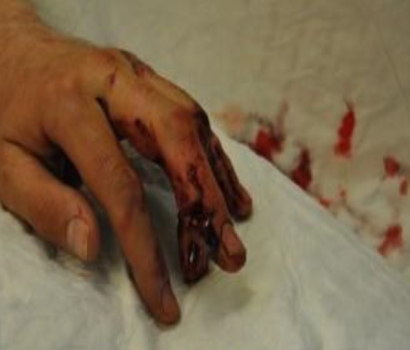 Main image for Posties suffer horrific dog attack injuries