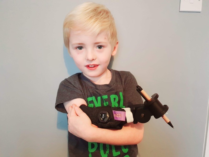 Main image for Kids’ charity secures ten revolutionary limbs