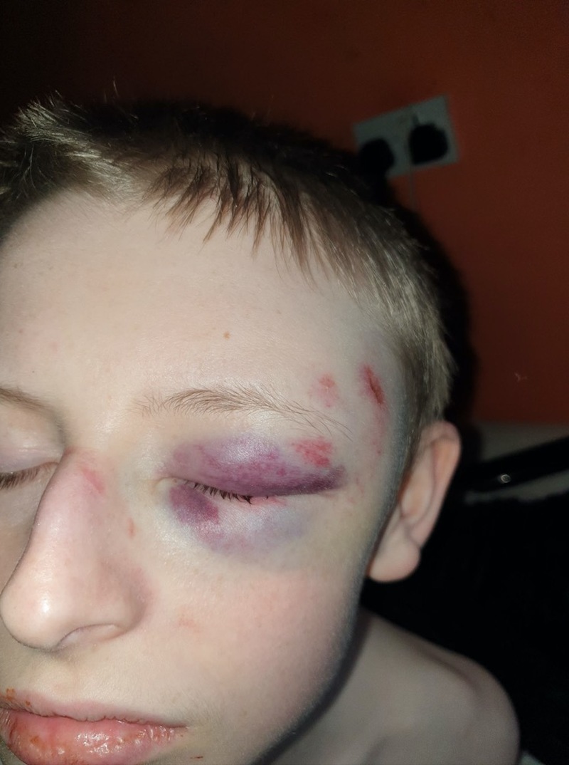 Main image for Police look into alleged assault on autistic teen