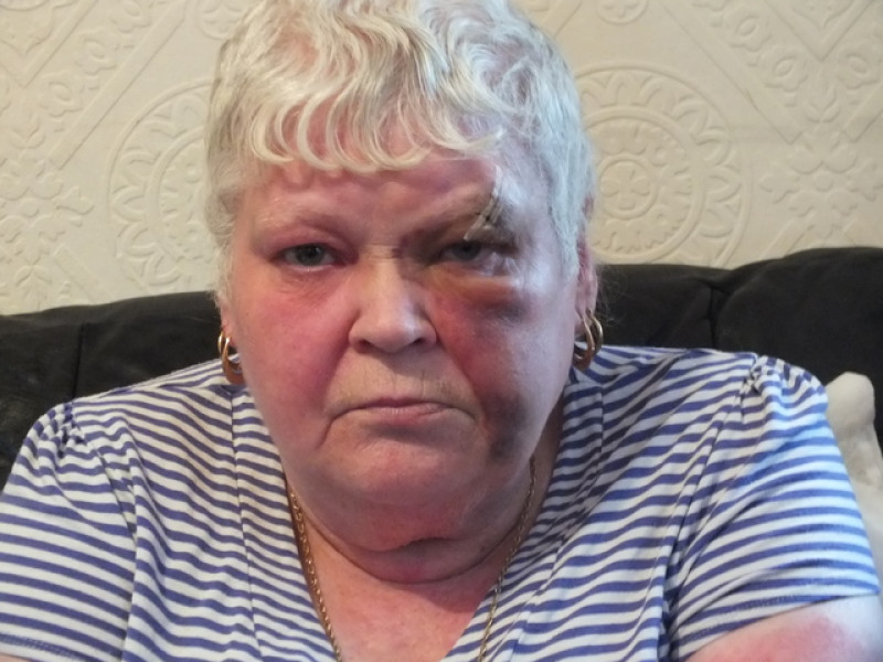 Main image for Great-grandma 'smashed over head with brick'