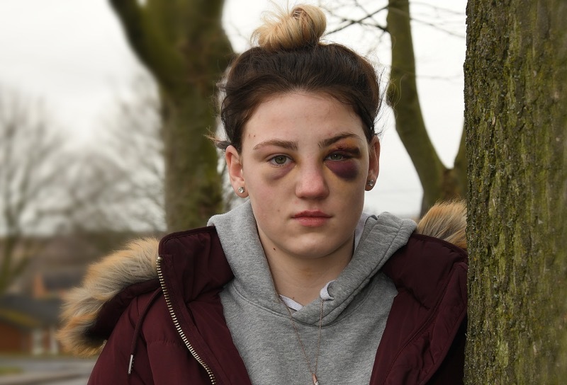 Main image for Teen’s mum speaks out after shocking assault