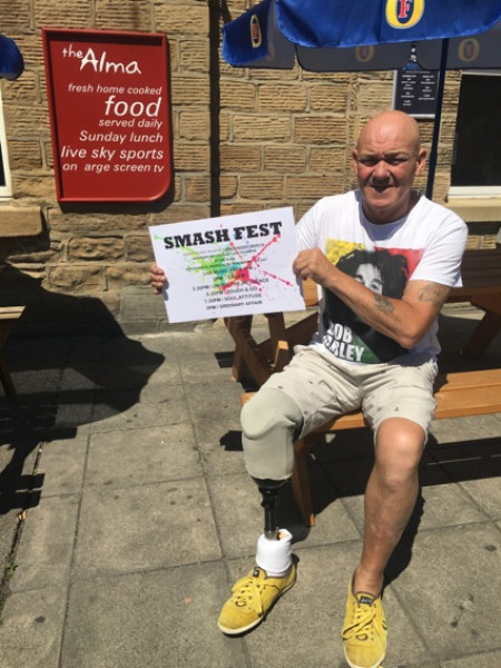 Main image for Amputee organises music festival to pay back helpers