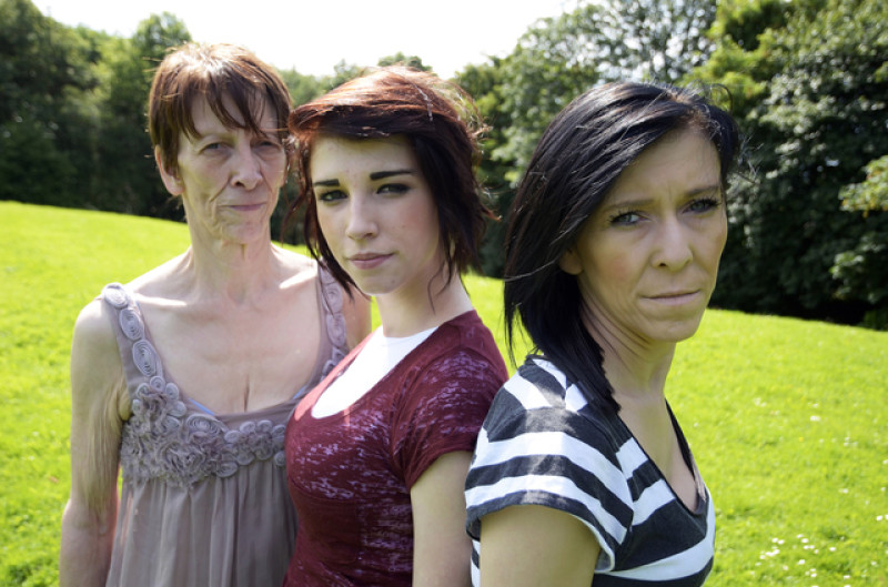 Main image for 'Middle-aged' 16-year-old has plastic surgery