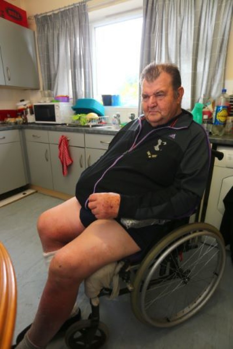 Main image for ‘Hip surgery has left me a prisoner in my own home’ claim