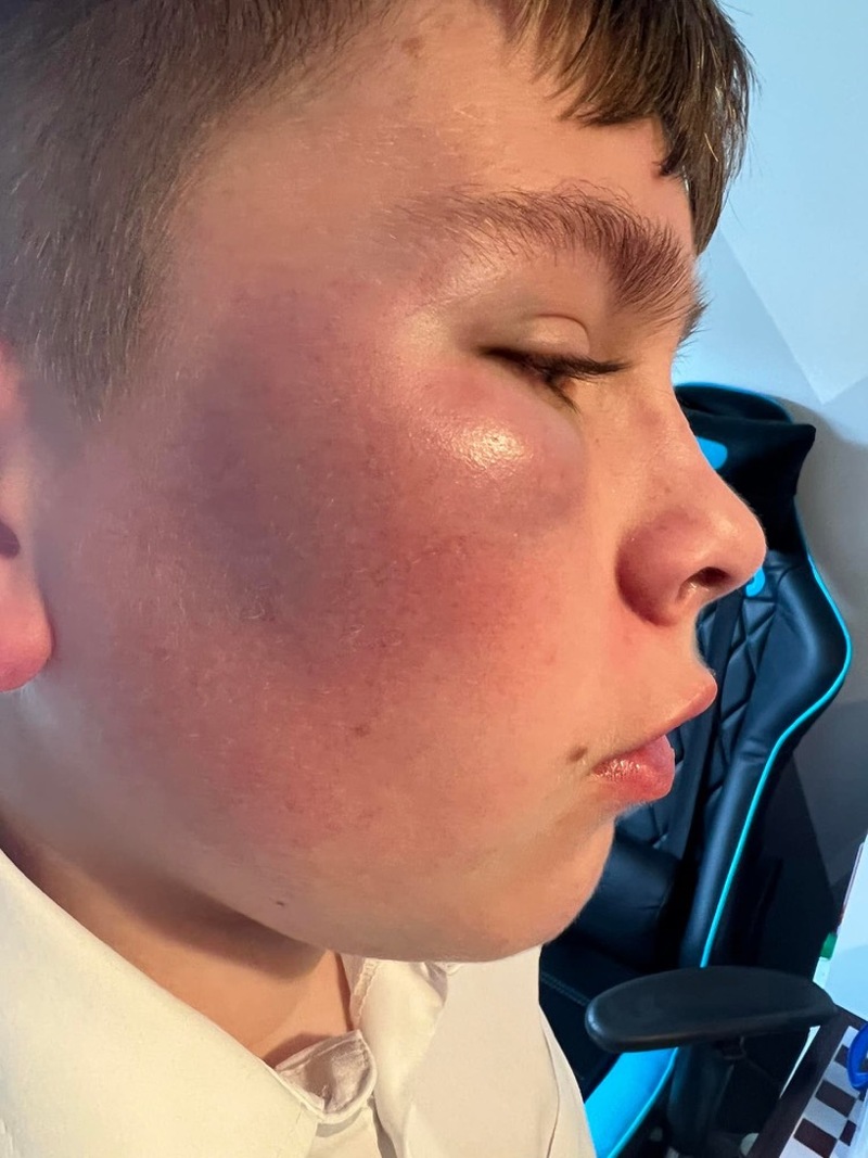 Main image for Police probe boy’s assault