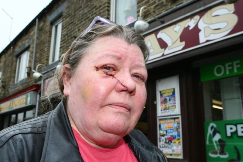 Main image for Shopkeeper back at work after knife attack