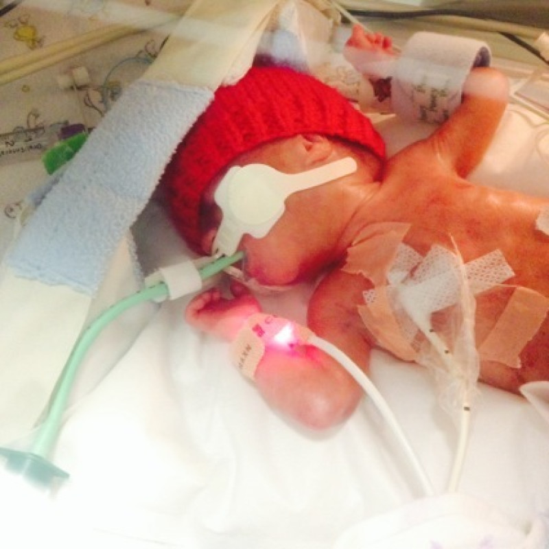 Main image for Tiny hearts appeal plea from heartbroken couple