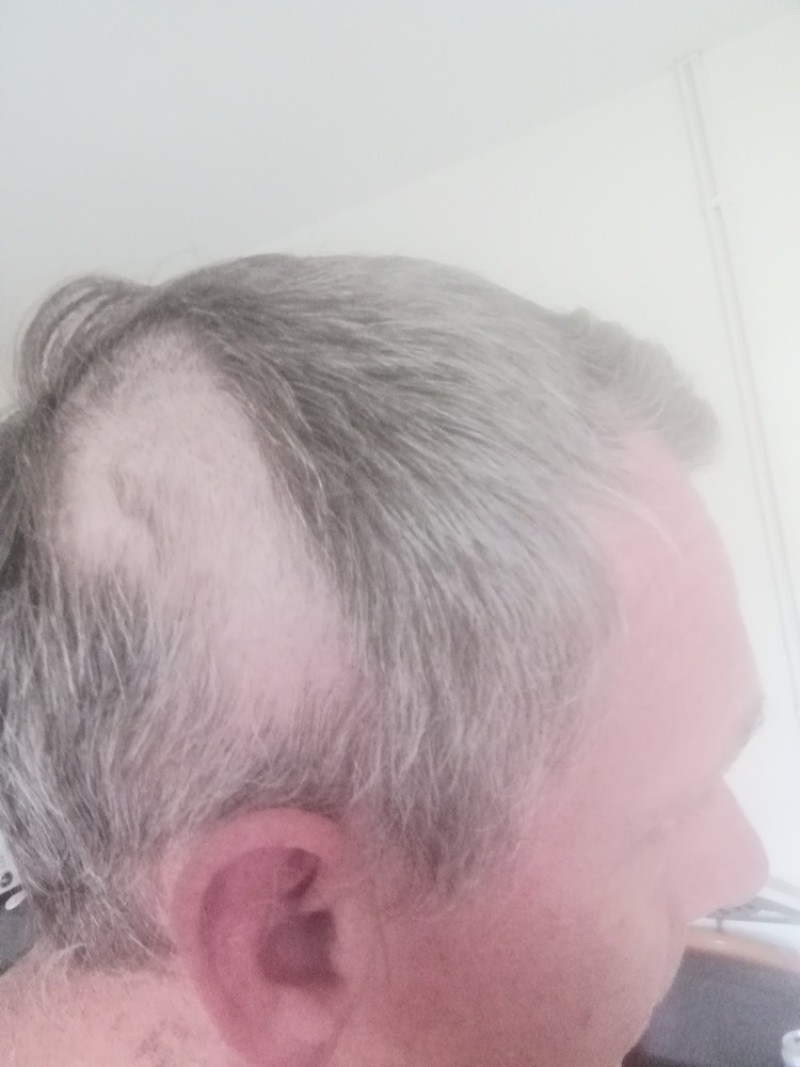 Main image for ‘I’ll never do it again’ admits DIY trim winner