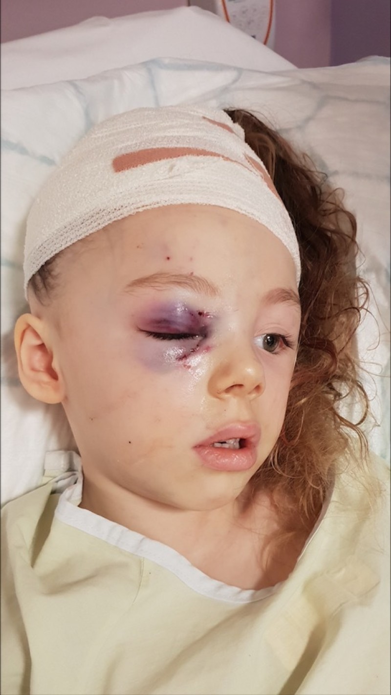 Main image for Sophie is ‘fixed up’ after harrowing dog attack