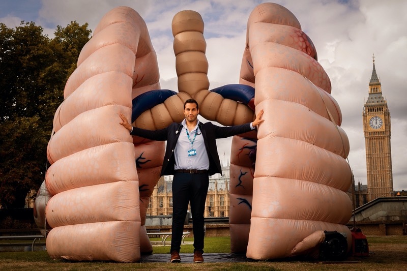 Main image for Medics concerned about town’s high lung cancer rates
